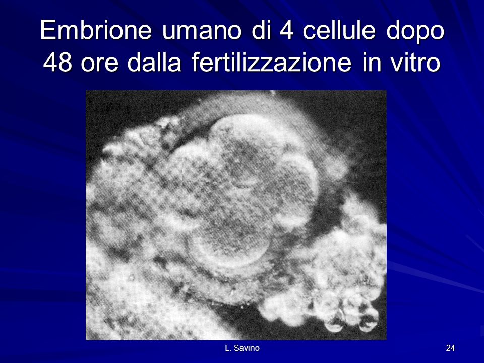 Embrione umano di 4 cellule dopo 48 ore dalla fertilizzazione in vitro