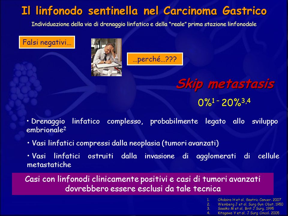 Il linfonodo sentinella nel Carcinoma Gastrico