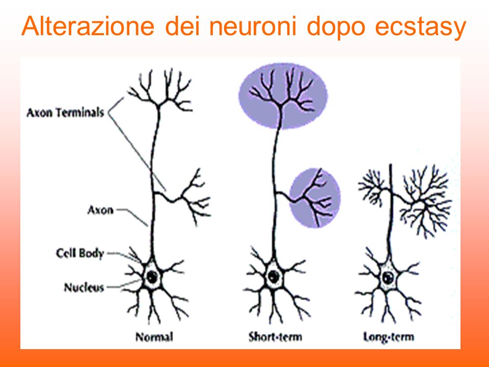 Alterazione dei neuroni dopo ecstasy