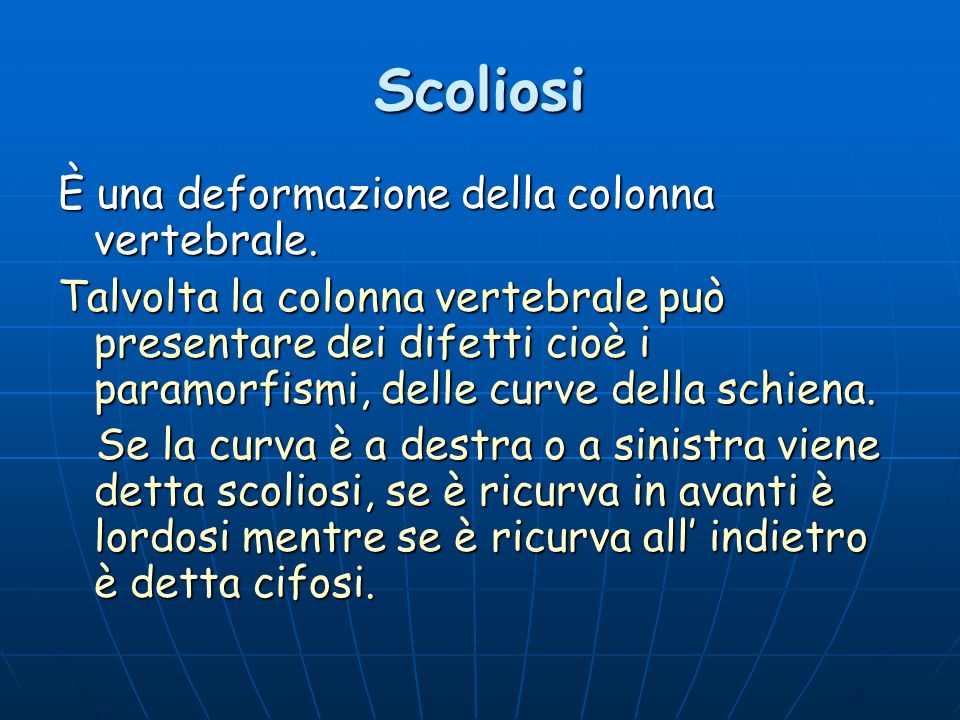 Scoliosi È una deformazione della colonna vertebrale.