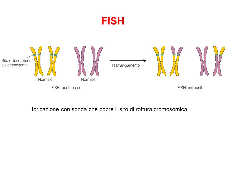 FISH Ibridazione con sonda che copre il sito di rottura cromosomica