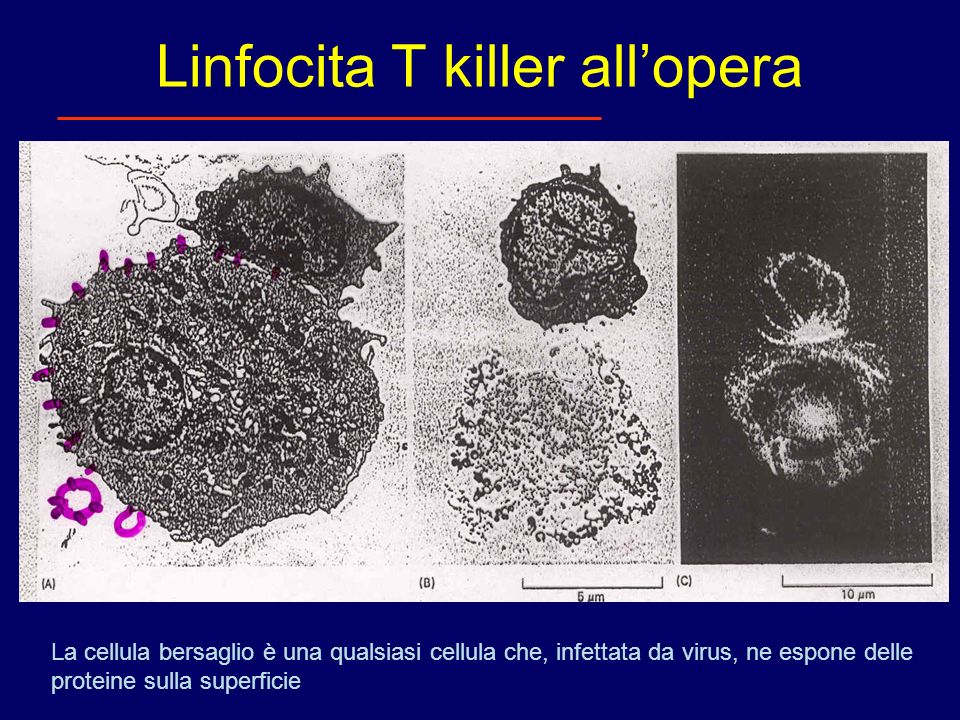 Linfocita T killer all’opera