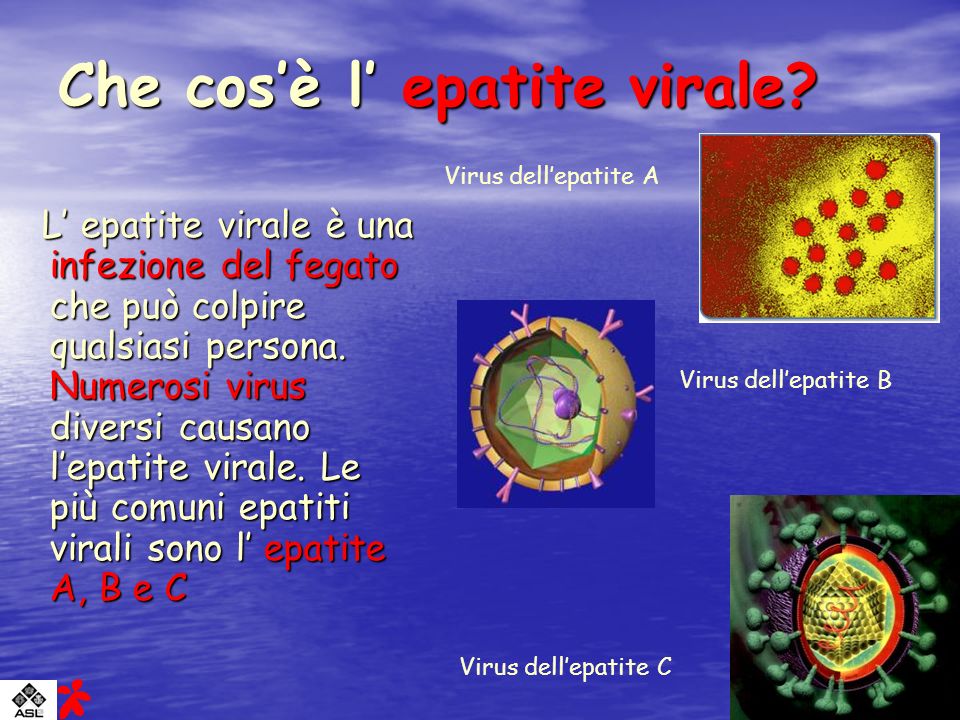 Che cos’è l’ epatite virale