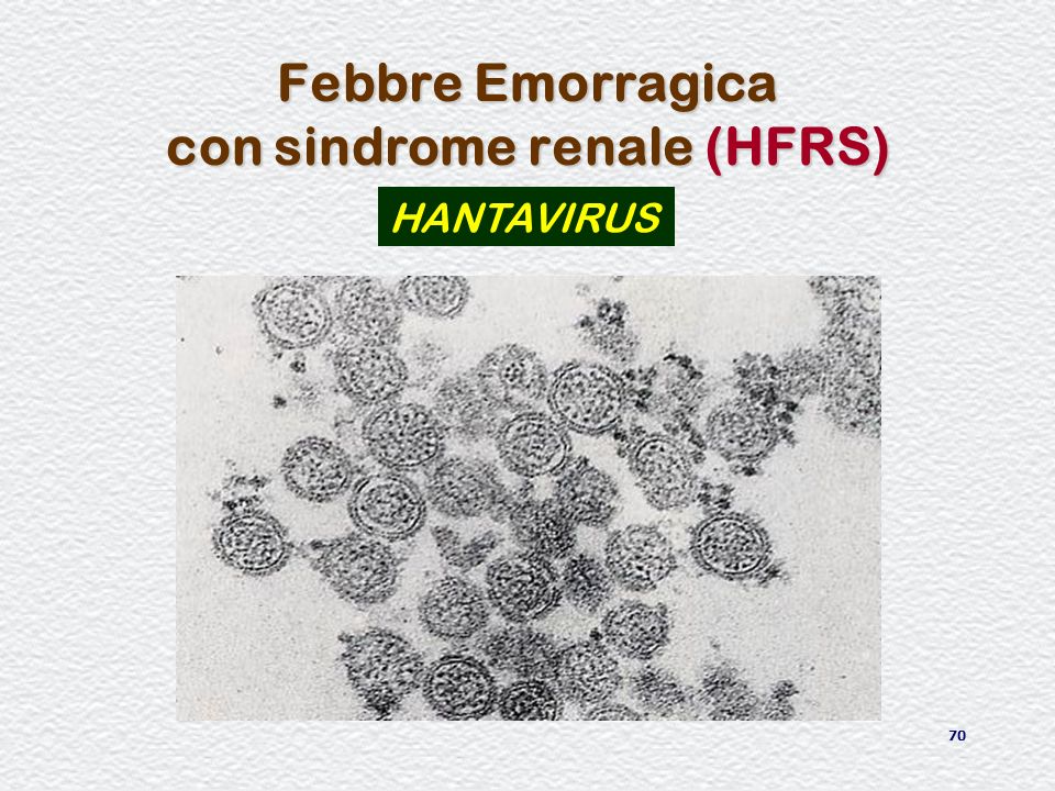 Febbre Emorragica con sindrome renale (HFRS)