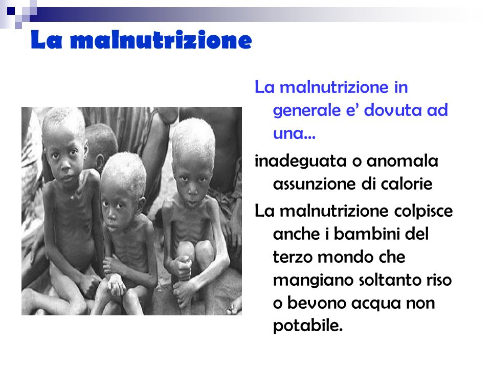 La malnutrizione