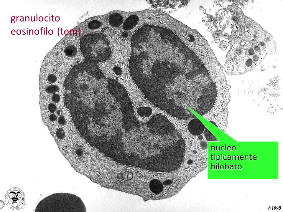 granulocito eosinofilo (tem)