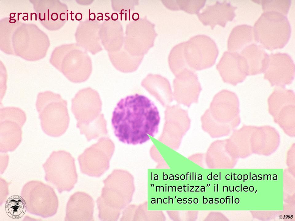 granulocito basofilo la basofilia del citoplasma mimetizza il nucleo, anch’esso basofilo