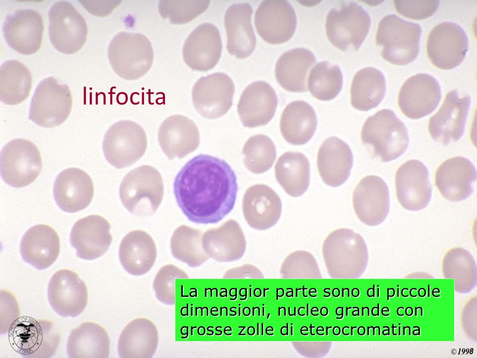 linfocita La maggior parte sono di piccole dimensioni, nucleo grande con grosse zolle di eterocromatina.
