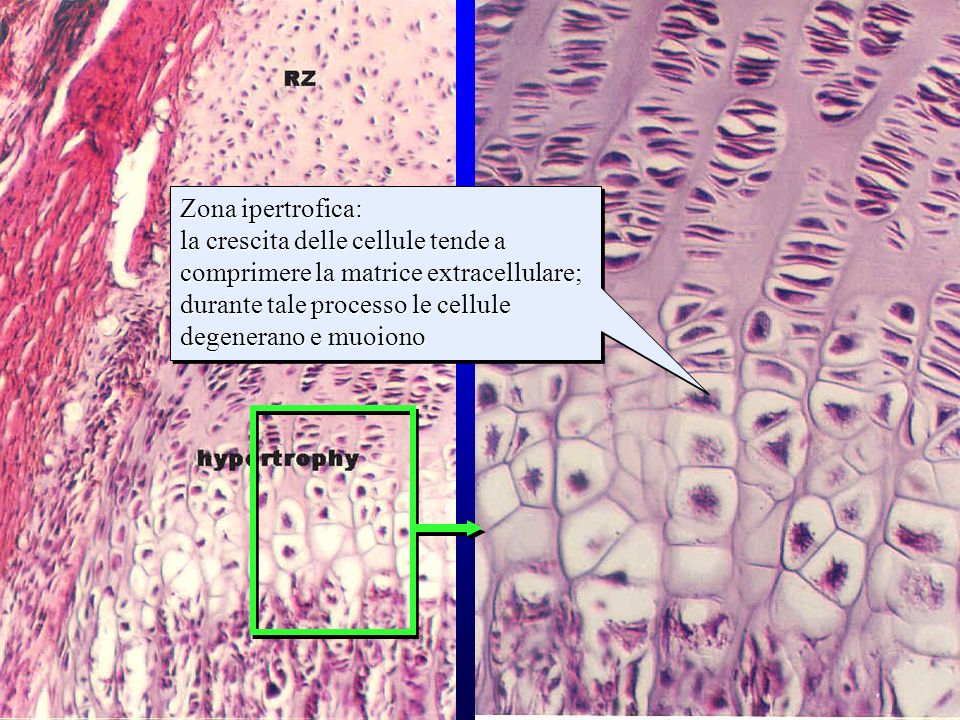strati della cartilagine di accrescimento (2)