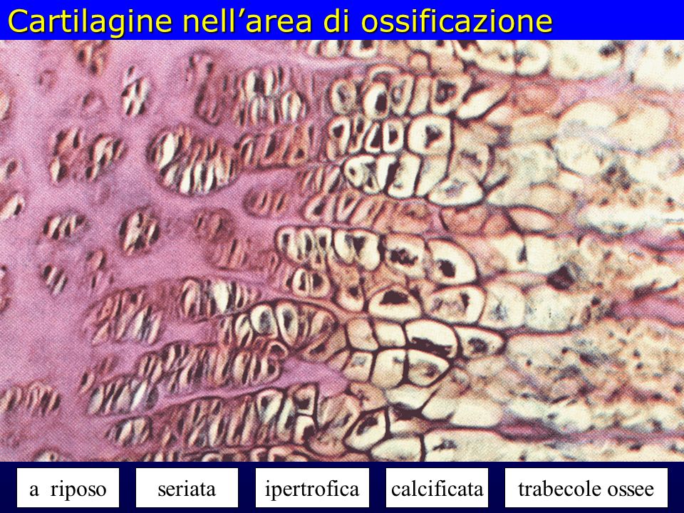 Cartilagine nell’area di ossificazione