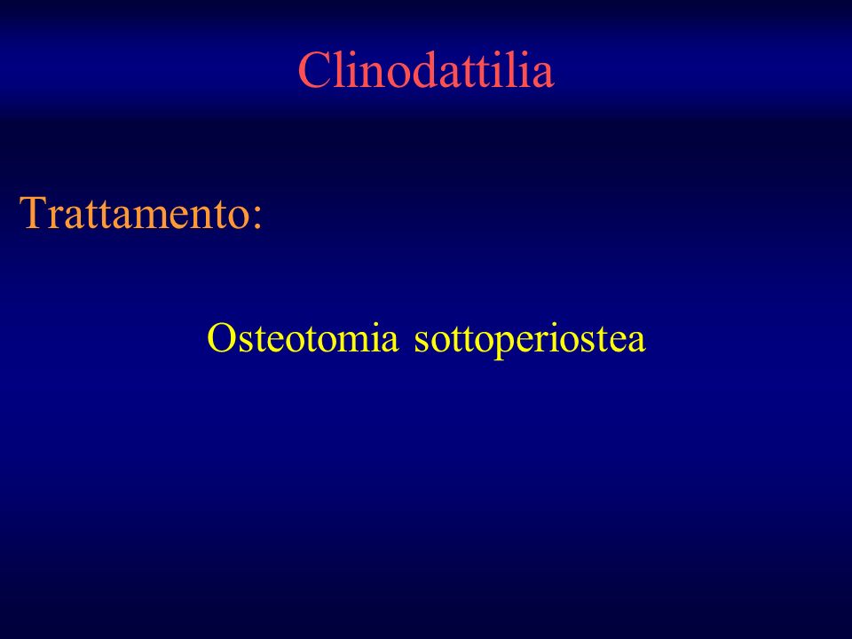 Trattamento: Osteotomia sottoperiostea