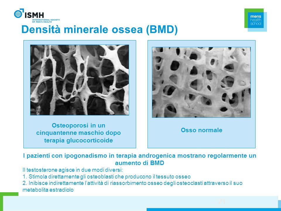 Densità minerale ossea (BMD)