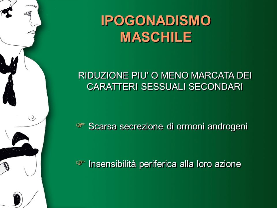 IPOGONADISMO MASCHILE