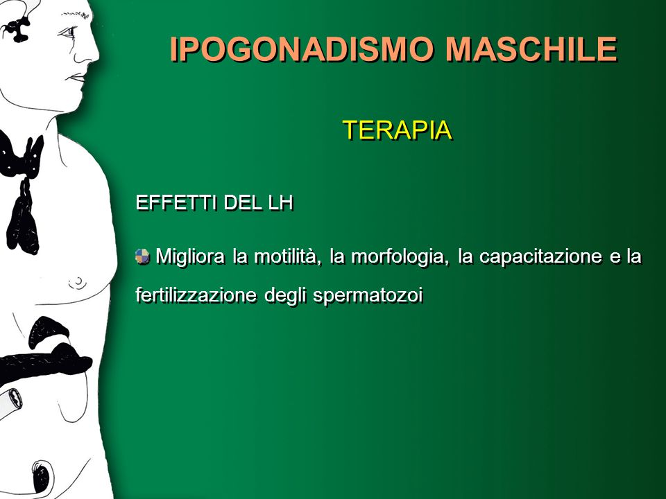 IPOGONADISMO MASCHILE